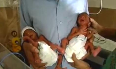 Oldest mother to give birth to twins