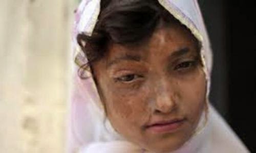 Taliban Increase Acid Attacks Against Female School Students