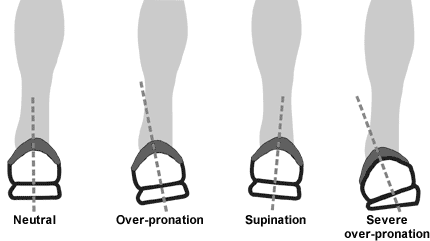 Foot Types