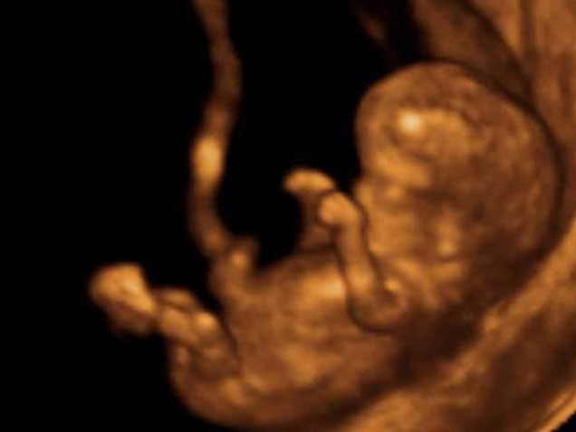 12 недель видео. Плод на 12 неделе беременности УЗИ. 12 Недель беременности фото плода на УЗИ. УЗИ 12 недель беременности УЗИ 12 недель беременности. Снимок УЗИ на 12 неделе беременности.