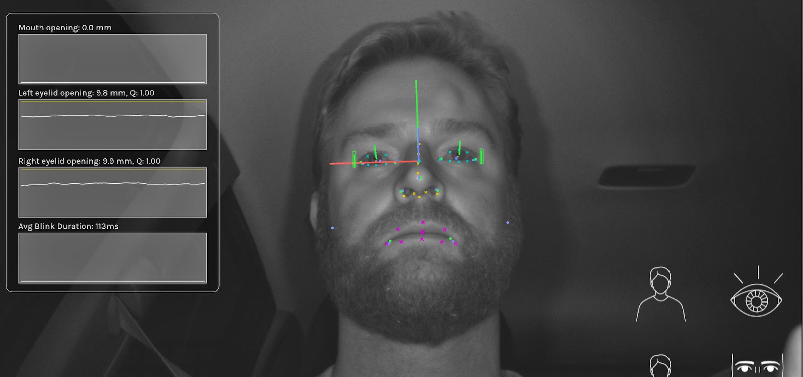 Smart Eye Driver Monitoring System