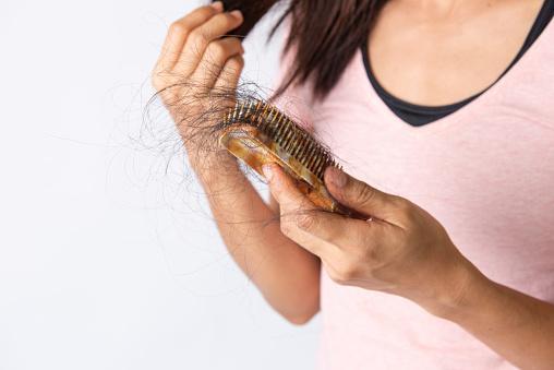 Is There A Cure For Hair Loss Caused By Pcos?