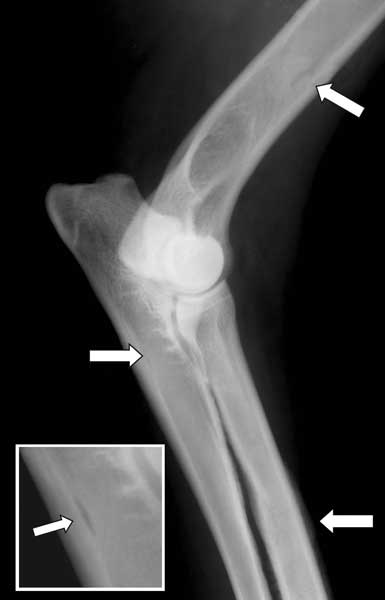 Radiographic signs of panosteitis evident in the humerus, radius and ulna of the same leg