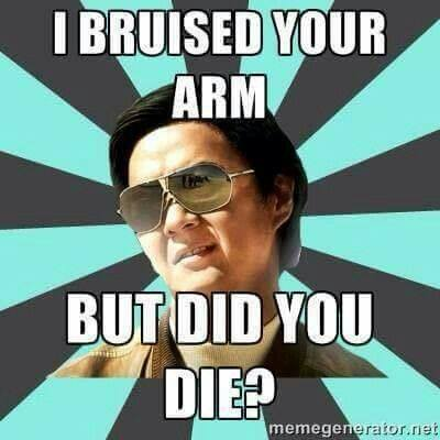 I bruised your arm but did you die?