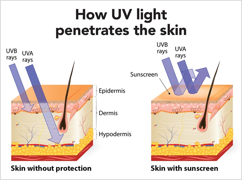 Differences between skin without protection and skin with sunscreen