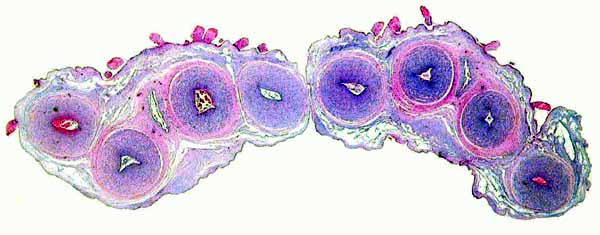 Two cross sections of this animal's umbilical cord with central allantoic duct and granules of squamous metaplasia mostly located only on the upper surface