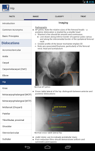 Download Ortho Traumapedia apk