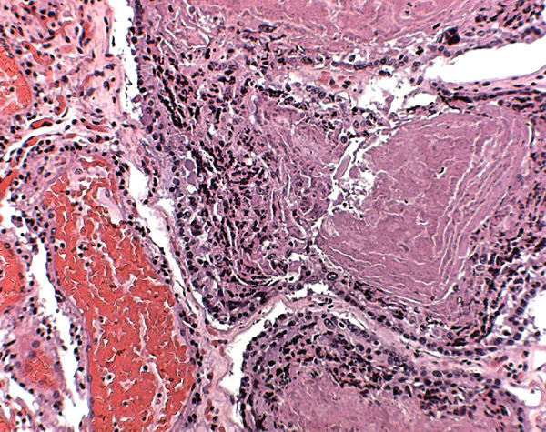 Higher magnification of central trophoblastic region that eventuates in the hemophagous sac