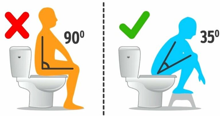 Tư thế đi vệ sinh đúng cách là ngồi nghiêng một góc 35 độ