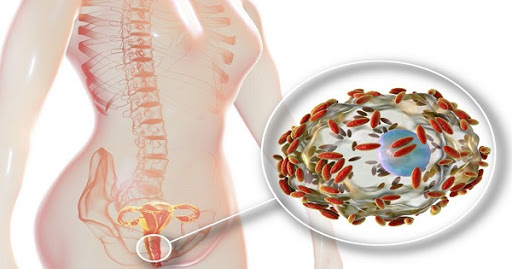 Viêm âm đạo do vi khuẩn có hại phát triển mạnh