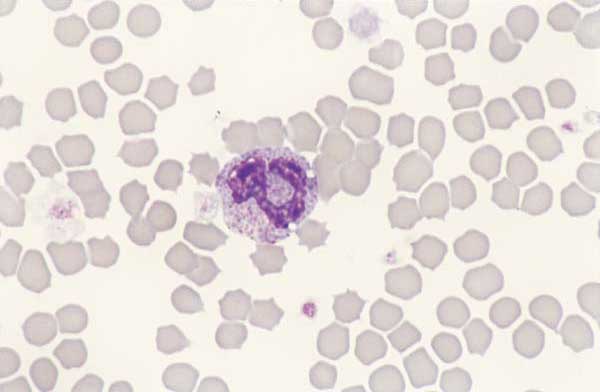 Feline basophil. Numerous round lavender granules surround a lobulated nucleus. Feline basophils can be easily confused with monocytes.