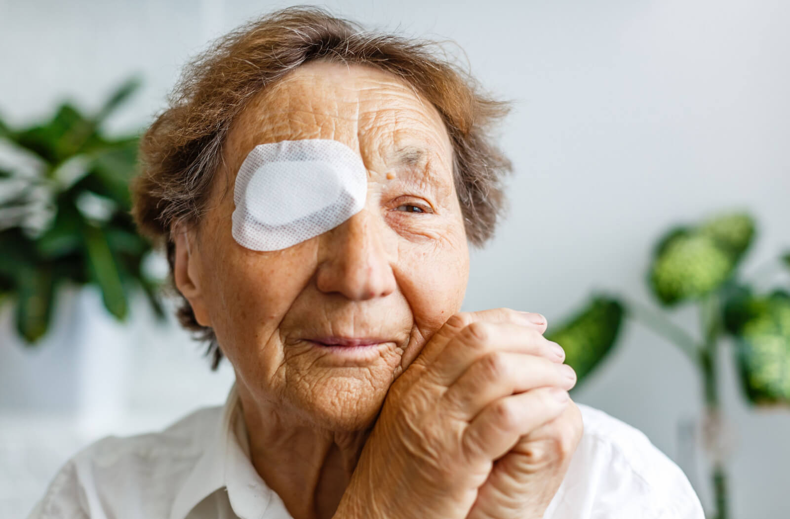 An elderly woman is using an eye shield covering after cataract surgery.