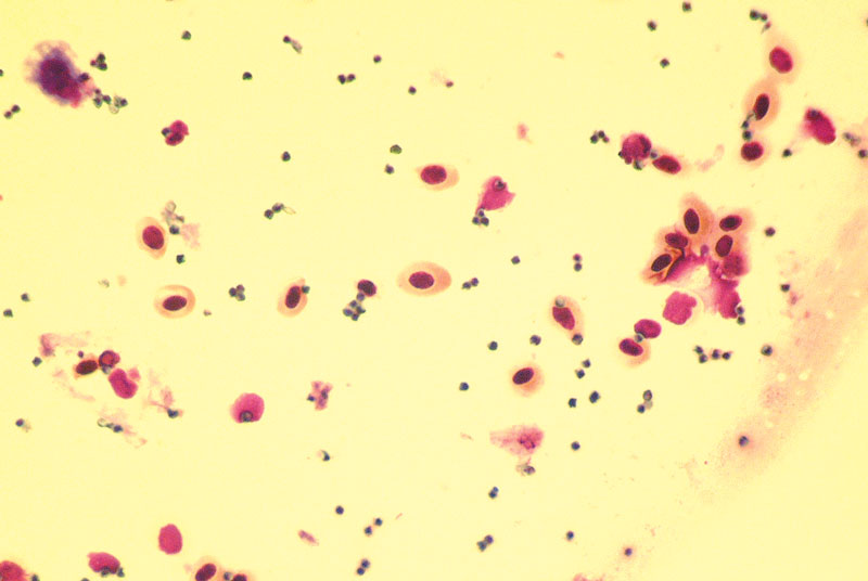 Aspergillus spores and avian red blood cells from a clinical sample obtained during diagnostic endoscopy