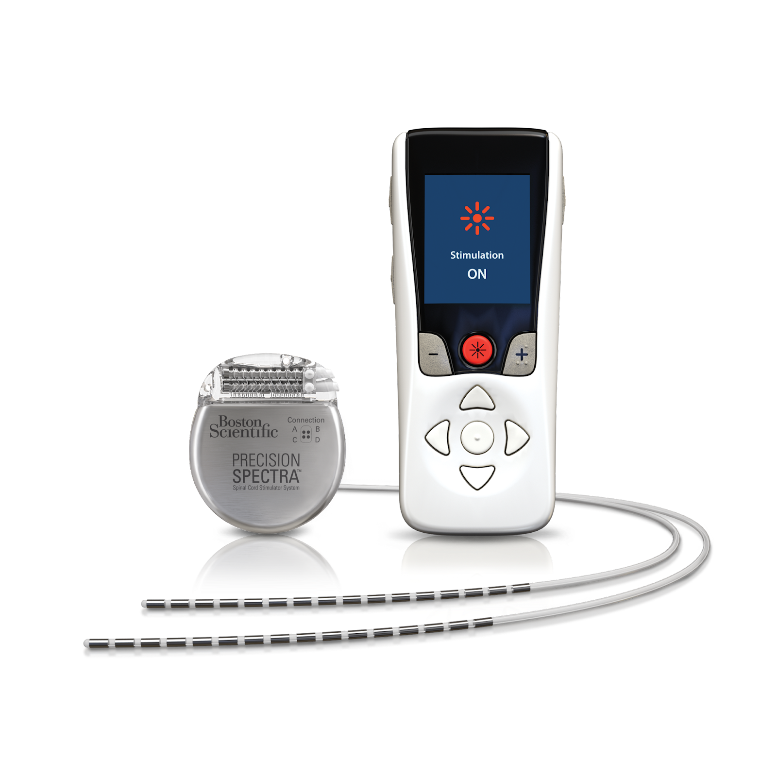 Boston Scientific Spinal Cord Stimulator Review Disadvantages And