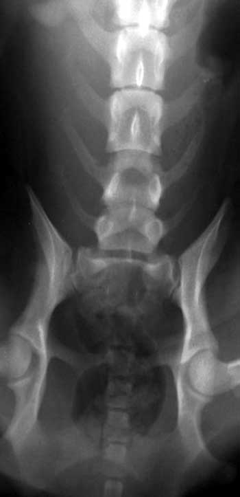 Ventrodorsal spine radiographs of a dog with traumatic vertebral subluxation