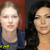 laura prepon plastic surgery before and after pictures