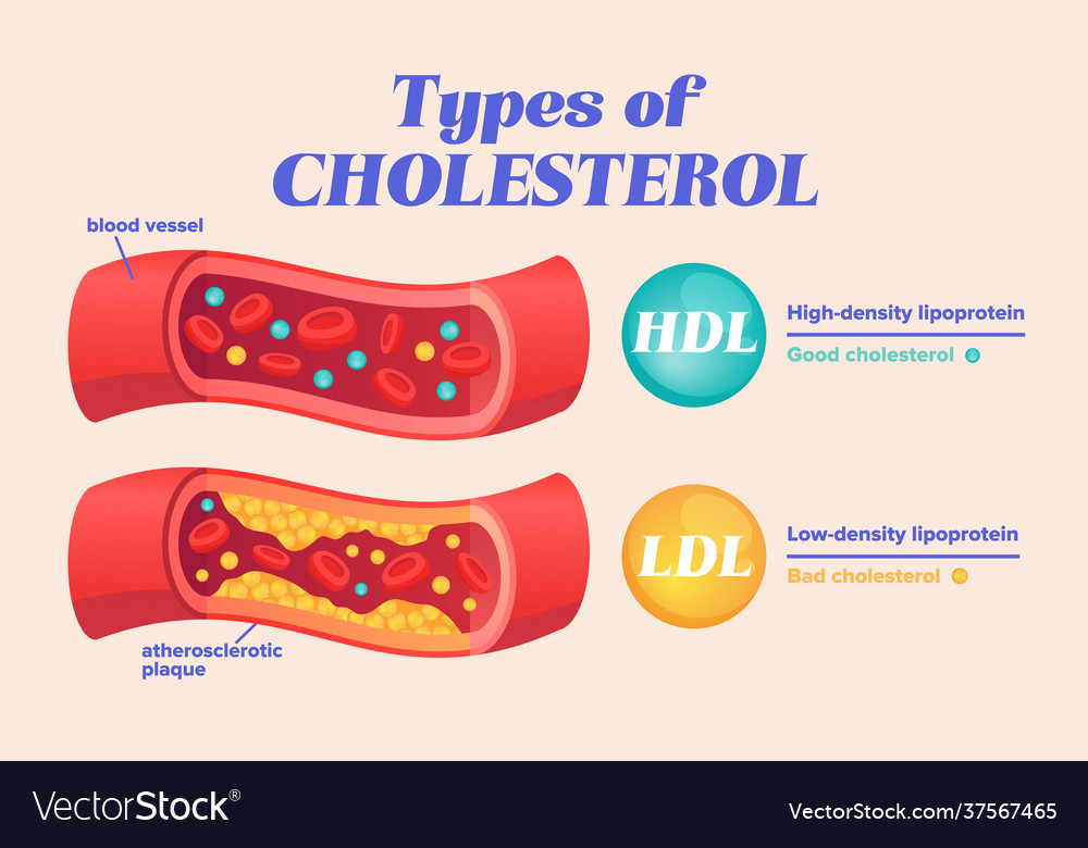 cholesterol types