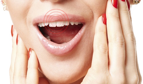 Nhức răng sau khi trám bắt nguồn từ lúc nào?