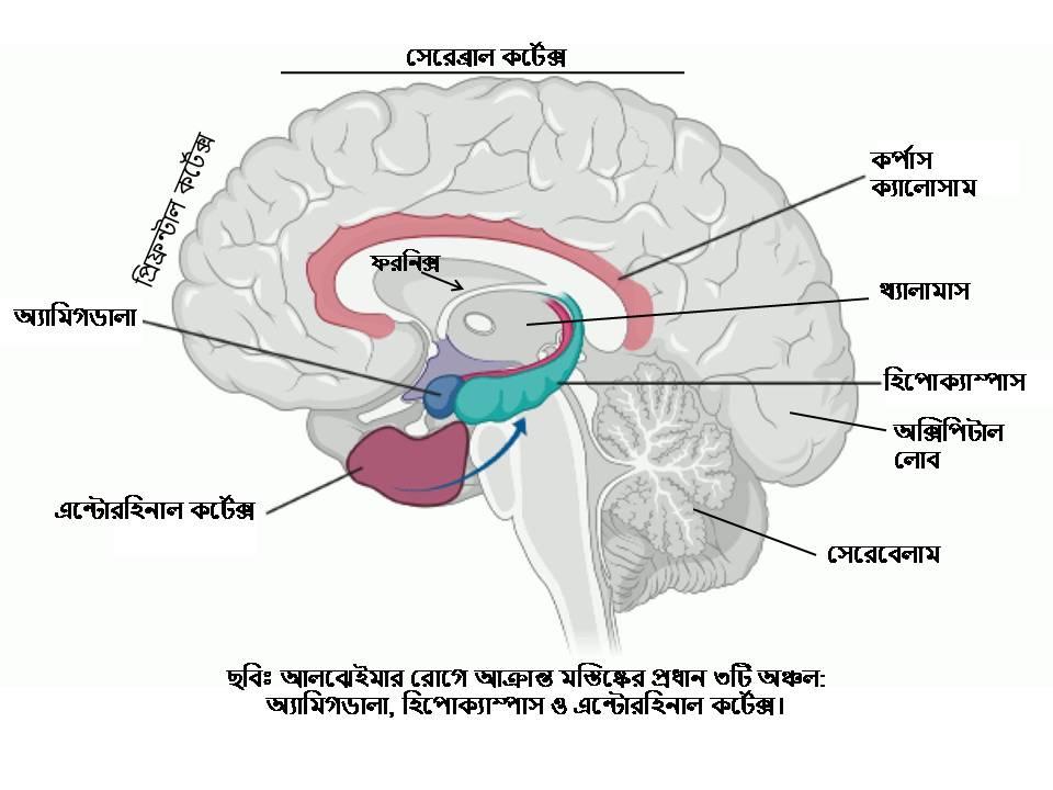 D:\Rashid\Alzheimers\Brain areas and Alzheimers-Rashid.jpg