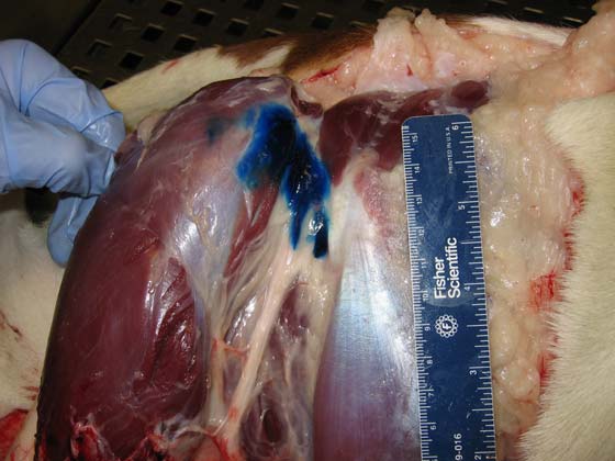 Cadaver dissection after a sciatic nerve block with methylene blue solution