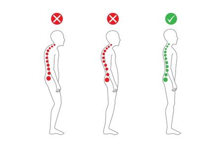 The Bad Posture Epidemic & How to Heal It – True North Chiropractic &  Wellness Center