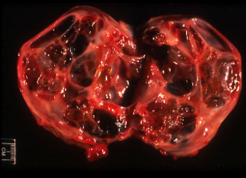 Ovarian granulosa cell tumor surgically removed from a mare. Note the multiple cystic structures within the affected ovary. The hallmark of granulosa cell tumors is the inactivity of the contralateral ovary.