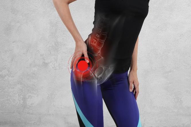 FAI - Femoral Acetabular Impingement