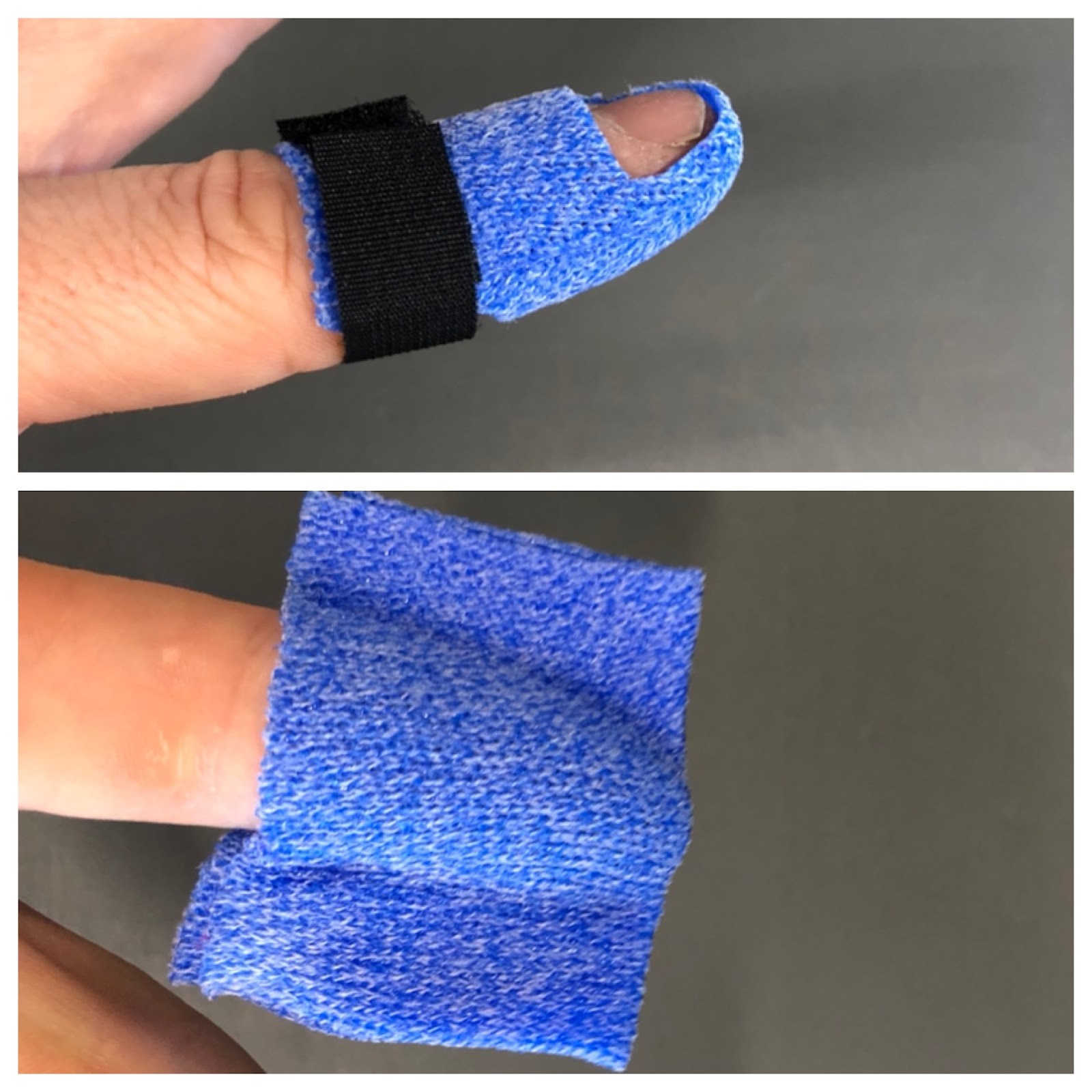 mallet finger splint pattern