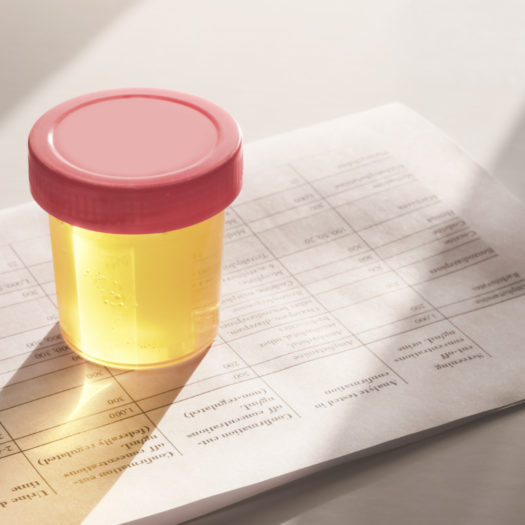 drug test urine cup