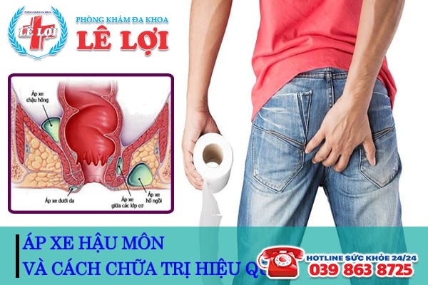 Phương pháp chữa áp xe hậu môn ở Vinh nhanh gọn và hiệu quả