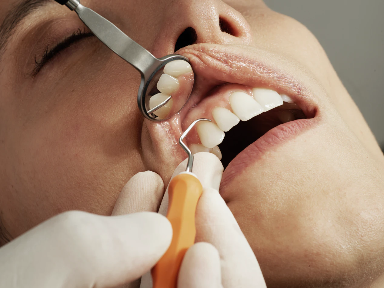 Jak dbać o szkliwo zębów? Jak je zregenerować i jak go nie niszczyć? - Dr  Hercka - Implantologia i Estetyka Stomatologiczna
