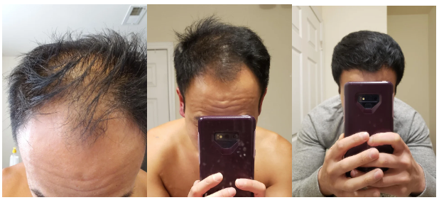 Trichofol Customer Reviews