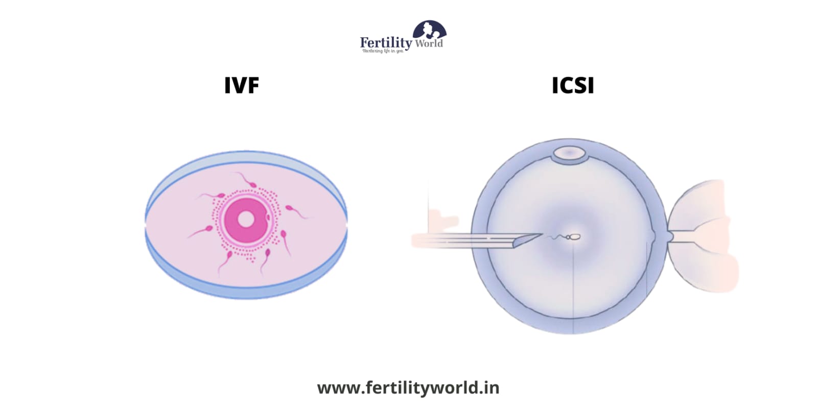 ICSI-IVF treatment