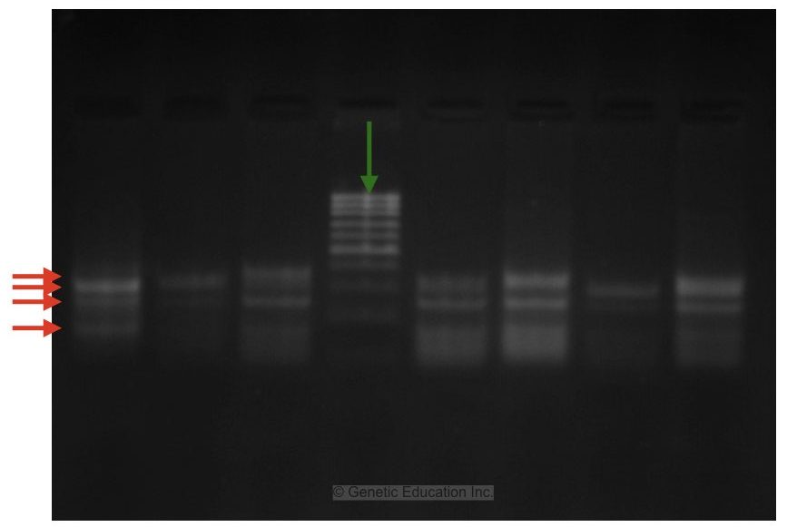 PCR gel electrophoresis result image  3.
