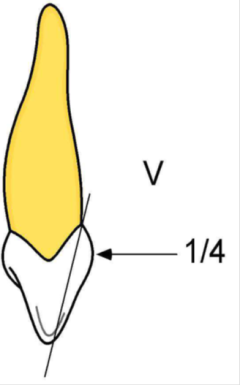 Généralités en anatomie dentaire