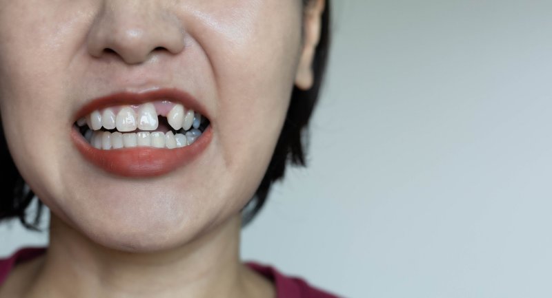 Có thể nhổ bỏ răng sâu để ngăn chặn biến chứng