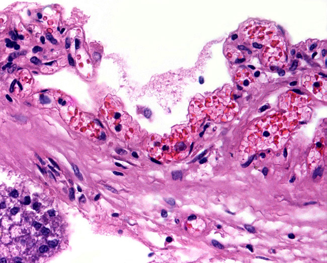 The endometrial surface has a vast array of thin capillaries