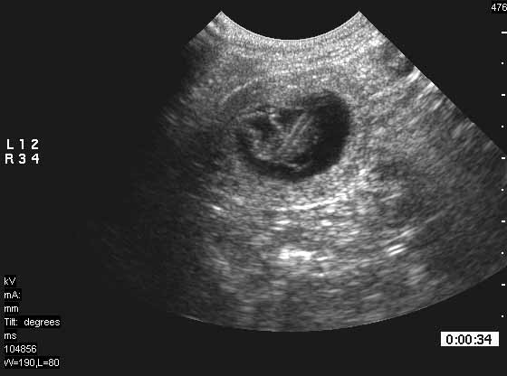 Ultrasound Imaging of the Reproductive Tract of the Bitch | IVIS
