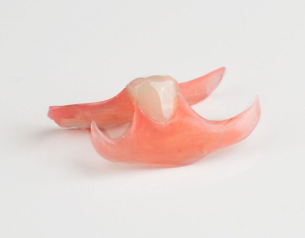 5HjiSEtnWTzSe5 AJ S7LH7HyBreNdiSyBCdSL Partial Dentures – What You Should Know