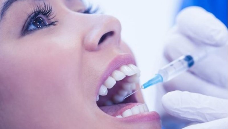 Gây tê trước khi hàn răng giúp giảm đau nhức khi thực hiện
