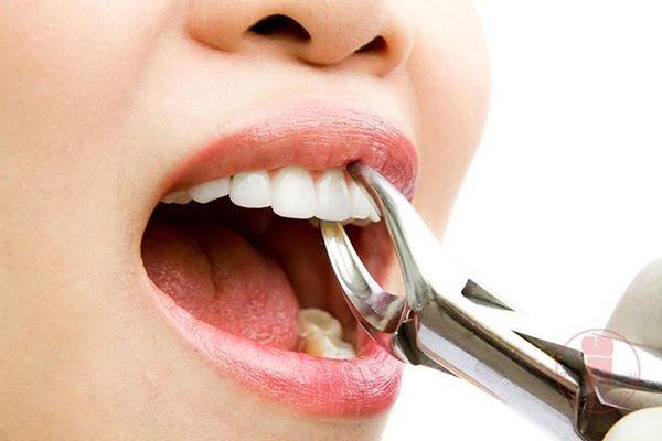Nằm mơ thấy nhổ răng và những điềm báo trong tương lai