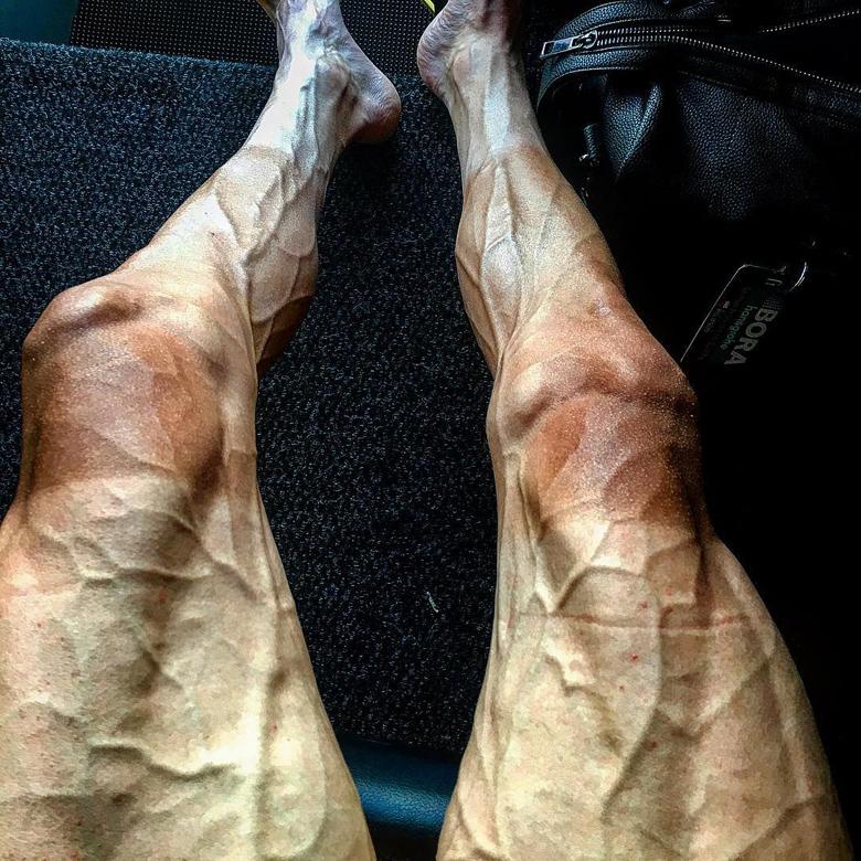 
Tương tự là trường hợp của Paweł Poljański, vận động viên đua xe đạp người Ba Lan. Đây là hình ảnh cặp chân vằn vện gân guốc của anh sau 16 chặng đua tại giải Tour de France năm 2017.