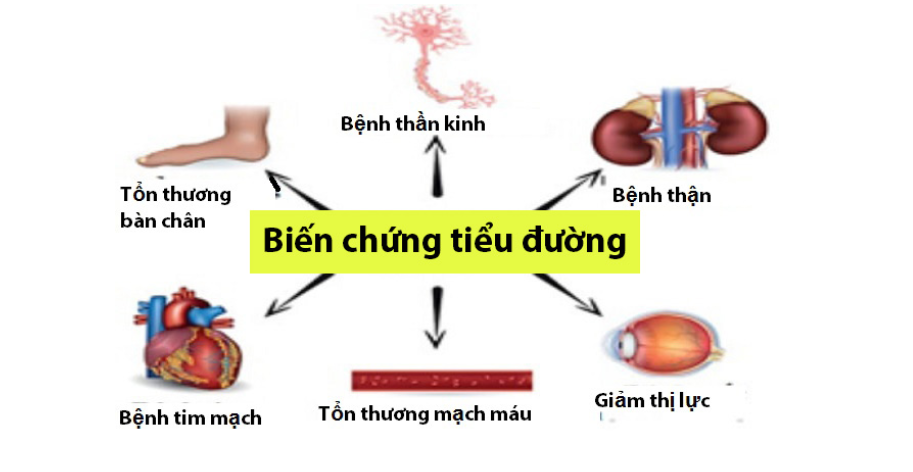 cách trị tiểu đường tại nhà