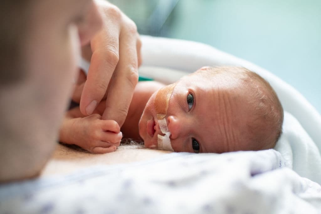 Premature baby due to excess milk consumption during pregnancy