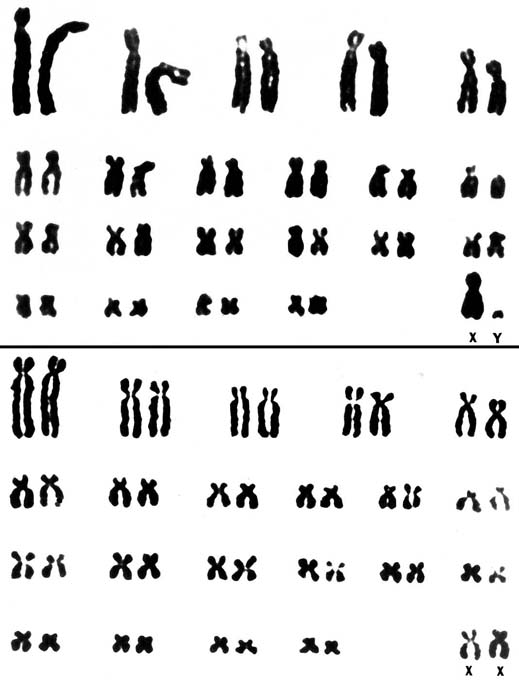 Karyotypes of male and female specimens
