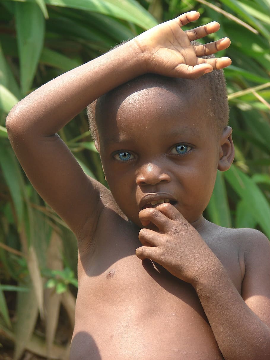 How Rare Are Black People With Blue Eyes? - Africa Global Radio