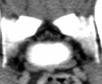 Transverse and sagittal CT images of the lumbosacral spine in a normal dog