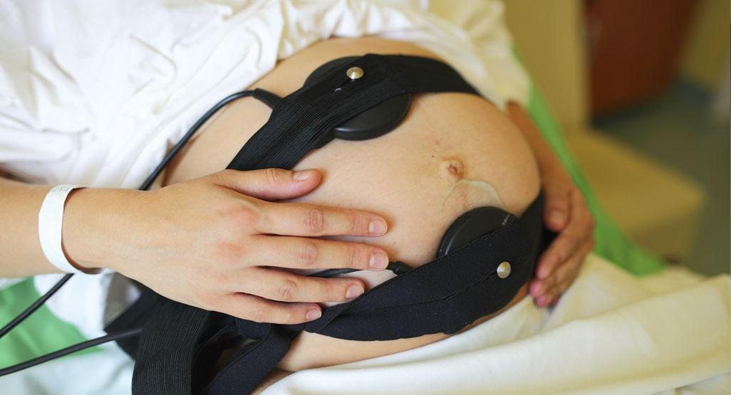 Imagem de uma grávida fazendo o exame Cardiotocografia para diagnosticar o sofrimento fetal agudo.