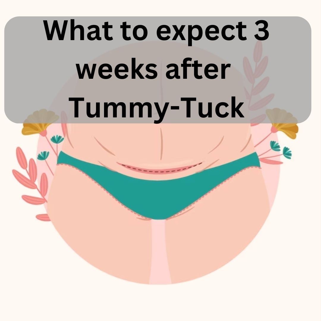 Tummy Tuck Recovery Timeline: Week by Week Recommendations