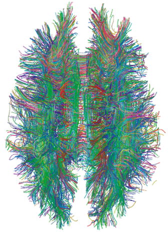 https://upload.wikimedia.org/wikipedia/commons/f/f2/White_Matter_Connections_Obtained_with_MRI_Tractography.png